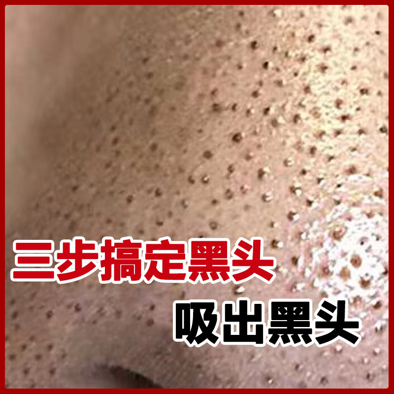 黒ずみ除去ノーズパッチキット、Tゾーンニキビ除去、毛穴縮小、黒ずみエクスポートリキッド、黒ずみ除去ノーズパッチ、ノーズパッチ|undefined