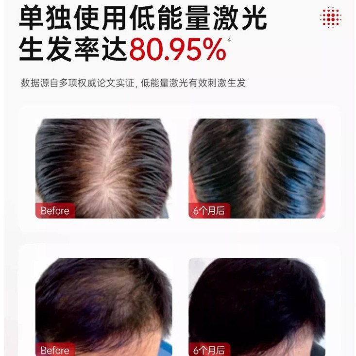 LLLT育毛キャップ工場 赤色光育毛 髪の毛の保護 生え際の保護 脱毛防止 健康育毛キャップ 頭皮ケア 育毛器工場|undefined