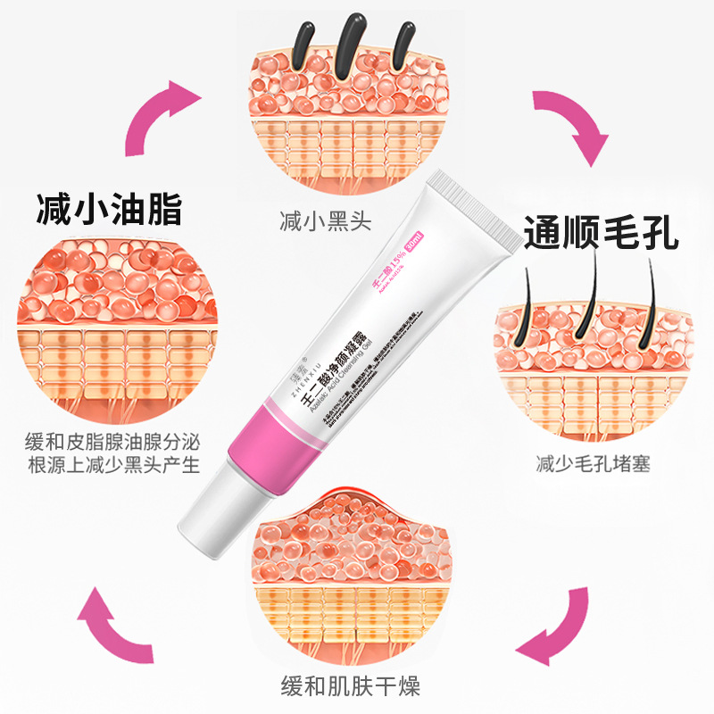 Perfect Shyness 15% Azelaic Acid Gel, Same as Blackhead Pore Shrinking Acne Scarring Treatment Cream