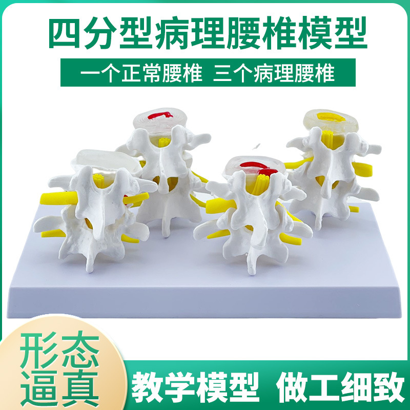 �ķ��ͼ�׵�����벡����׵���ģ�� ׵���̲�����׵��ʾ���� ����