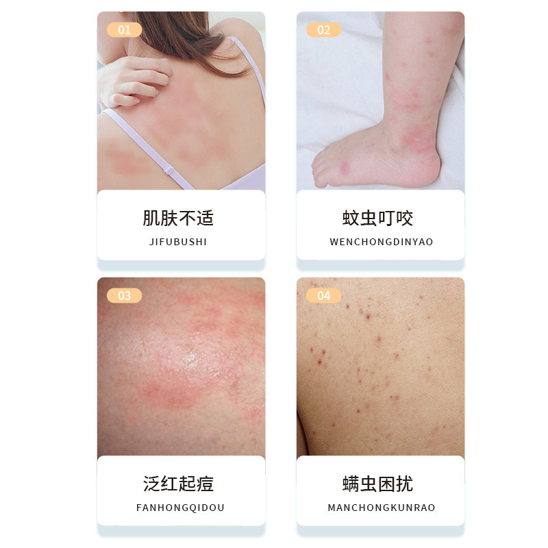 香港大薬局かゆみ止めクリーム家庭用屋外四季使用可能50g大容量硫黄軟膏硫黄軟膏|undefined