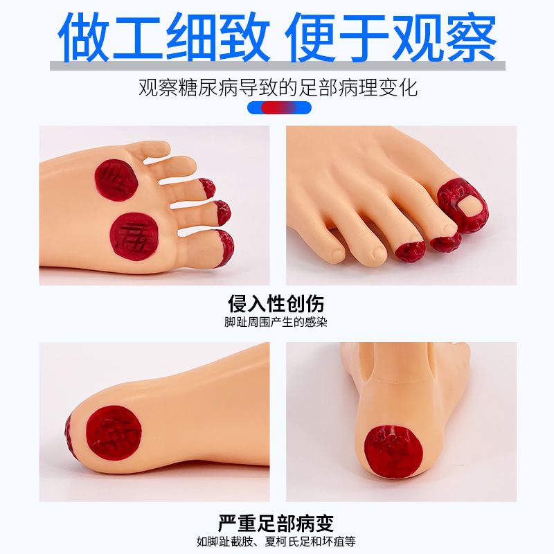 ��/���㻤��ģ�� ��/�򲡻����㲿����ģ���㲿�����仯��ģ��