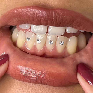 ���Q�aƷ����ɫ���¡����������荈A�����AB�ʲ���1.9-2.0mm