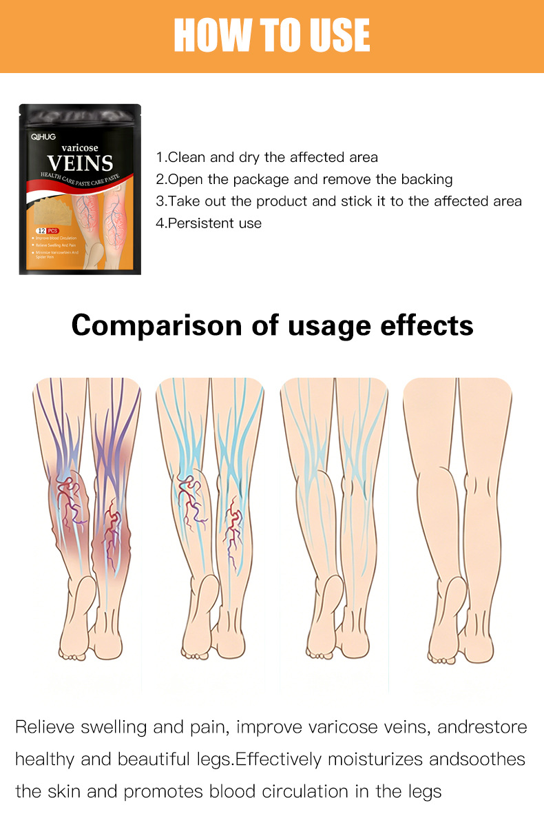 Varicose Vein Care Paste Patches Leg Support 12 Patches Per Pack External Use specifications