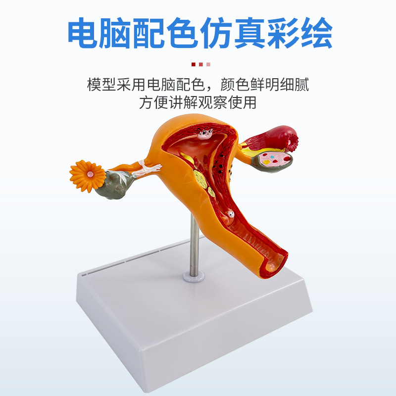 ҽѧŮ���ӹ�ģ���ѳ���ֳ�ṹ����ģ�͸��Ƹ������ѳ��ӹ�ģ��