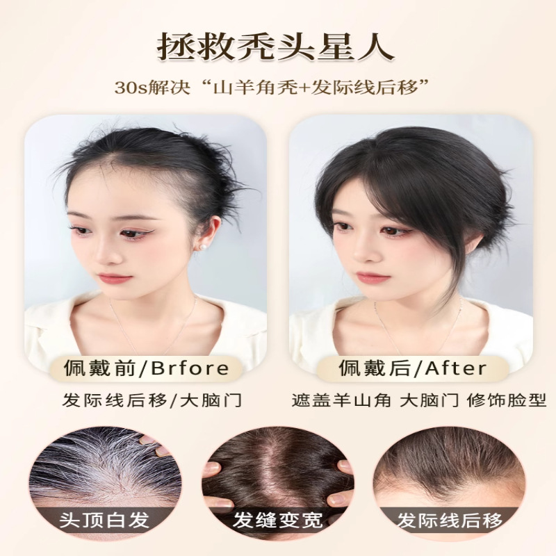 Peludo fetal pelucca de frangea de mujer cabeza de cabello verdadero ligero natural de ángulo de la frente rellenar cabello sin marcas de línea de cabello pelucca