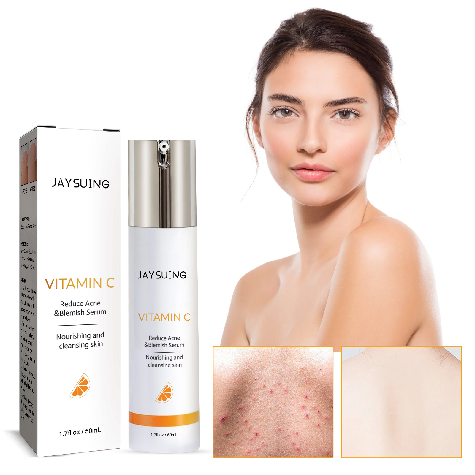 Jayusing Anti Cream Lighten and Acne Marks Esencja do nawilżania i naprawy skóry na ustach_voghion.com