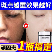 �������˪��Ч���C�ӏ���ȥ��ɫ��ը��˪�S�ְ������ȸ�����˪