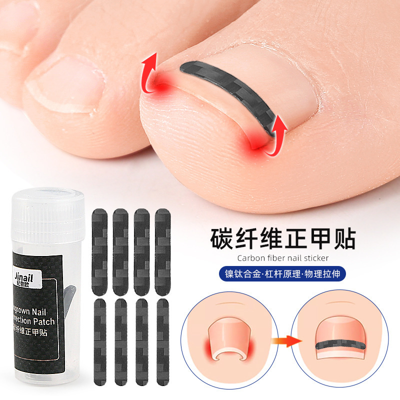 Fiber Nail Correction Patch, Ingrown Toenail Correction Device, Toenail Correction Tool