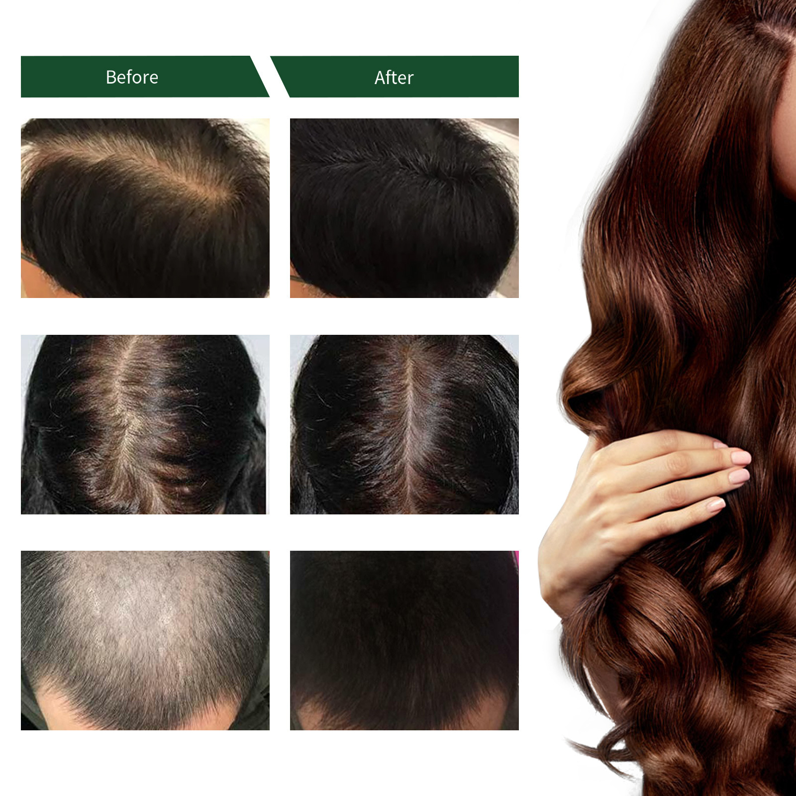 EELHOE ženšenniga juuksepaksuse sprei, juuksehooldus ja juuksehoolduse parandamine, juuksehooldus, niisutav ja juuste väljalangemise vastane toitev sprei_voghion.com