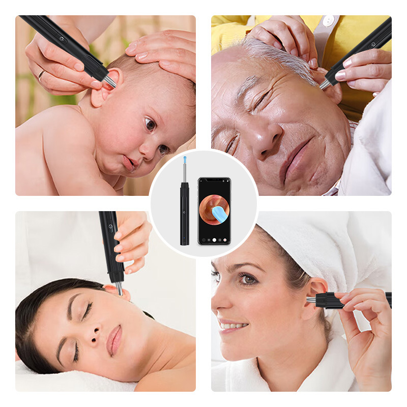 Visual Ear Pick High Definition Endoscope Children's Ear Cleaning Tool with Light Professional Ear Pick Cross Border Best Selling_voghion.com