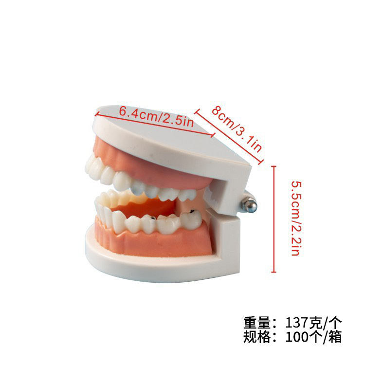 Modelo de caries dental para niños, modelo de cuidado de la enseñanza del cepillado de dientes de jardín de infantes, modelo de patología dental de la enseñanza oral