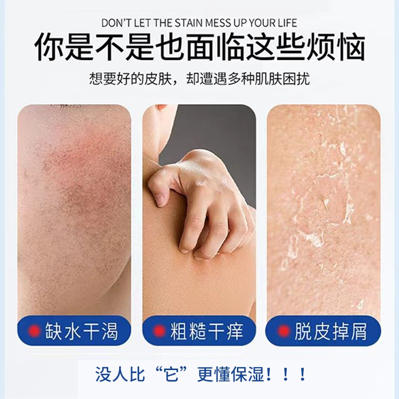 Su Shuisen ácido de fruta VE urea crema hidratación mejora la secedad vitamina E crema corporal hidratante fábrica directa