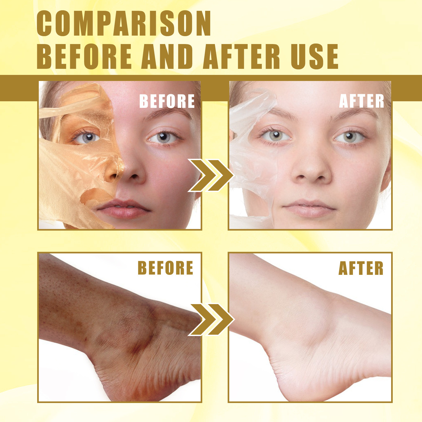 EELHOE-Öl zur Tiefenreinigung, zum Peeling abgestorbener Haut, zum Verblassen von Flecken, zur Befeuchtung, Aufhellung und Verschönerung_voghion.com