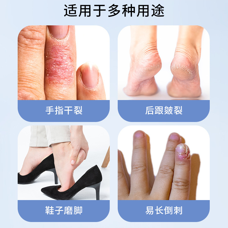 ドライクラックは手足の割れ目に貼ってあります。手足の皮膚はひび割れています。|undefined
