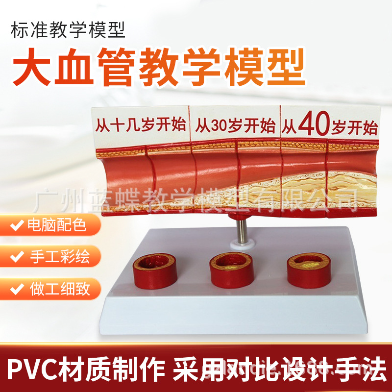 ����Ѫ�ܽ���ģ�� Ѫ��ģ�� ����/Ӳ��չʾ ���׶������Ѫ��չʾ