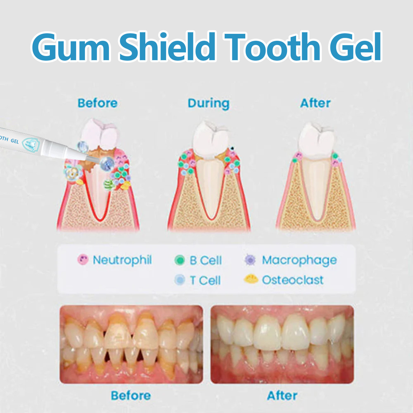 Penna gel per l'igiene orale dei denti bianchi per la pulizia delle macchie EELHOE_voghion.com