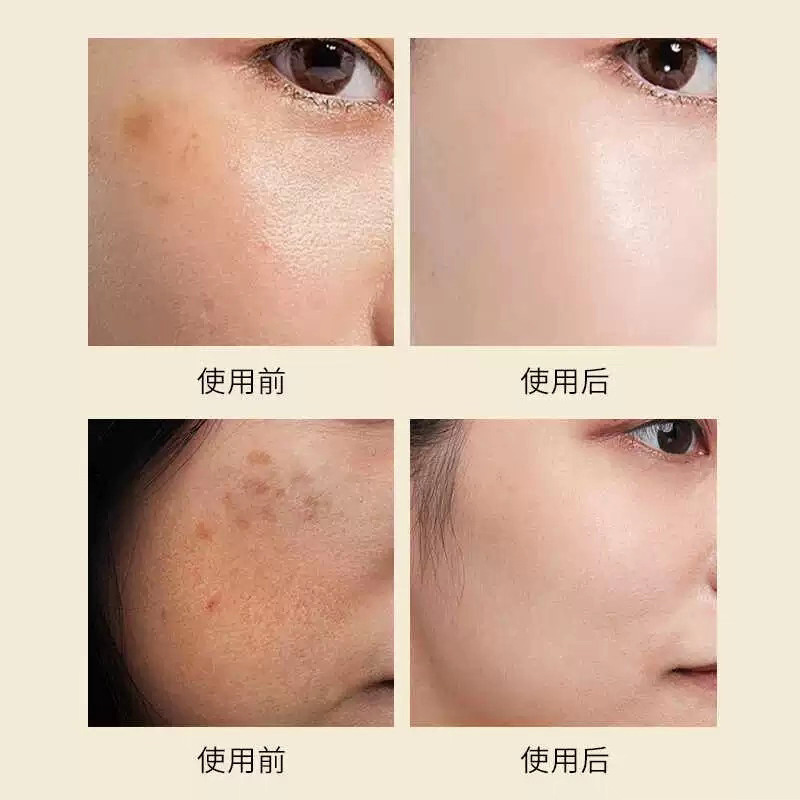 焕颜精华霜修颜清肤霜控色霜靓肤霜代谢霜点斑防止色素回流反黑|undefined