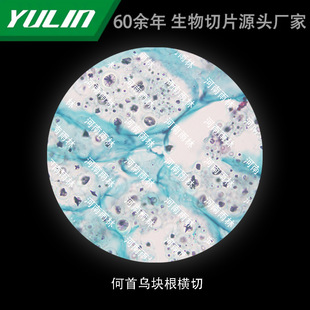 Polygonum Multiflorum Root Cross-cut College Medical School Tissue Disease Marble Wax Slide Specimen Microscope