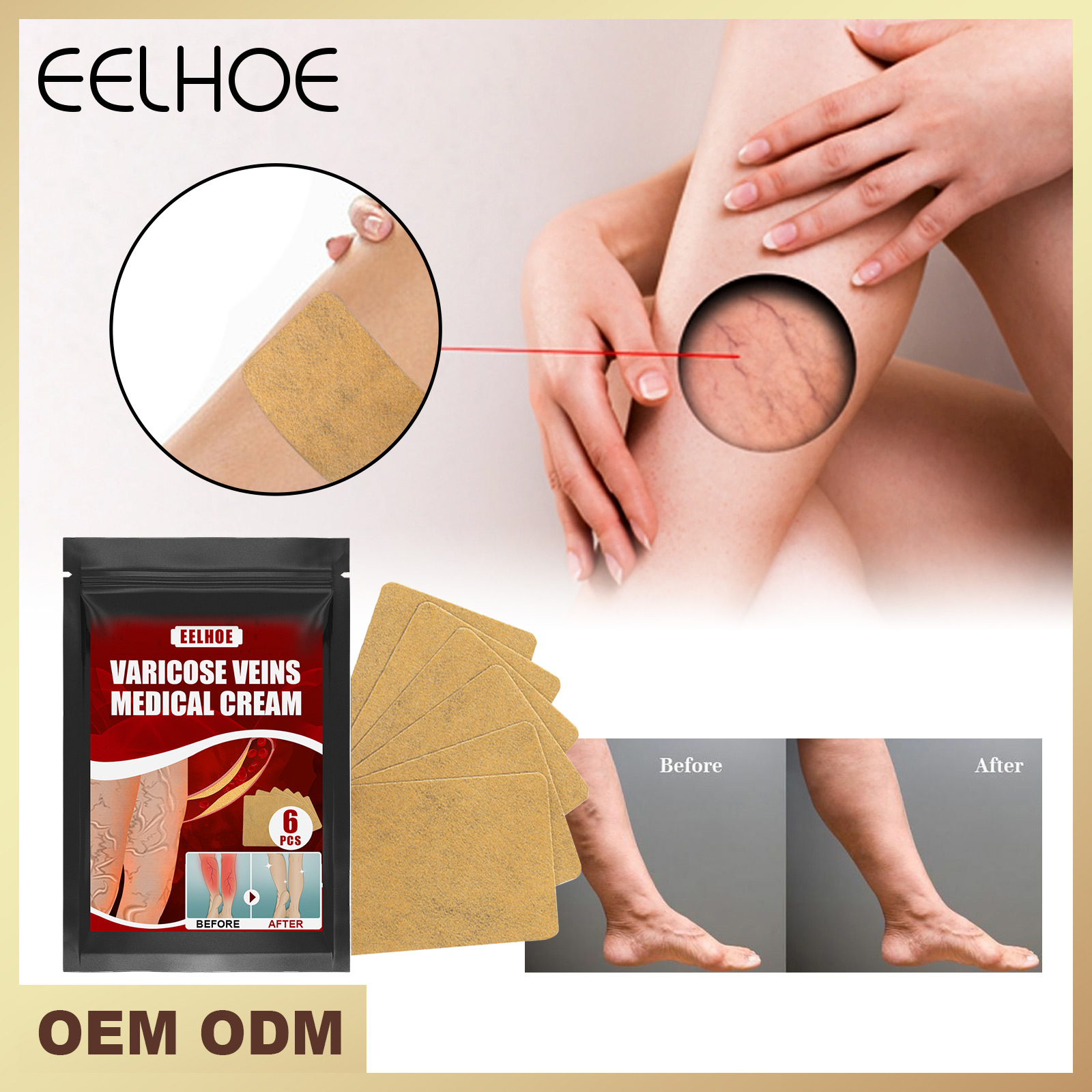 Massieren Sie das schöne venöse Krampfaderpflaster. Tragen Sie es auf geschwollene Beine auf. Regenwurm-Beinvenenmassage lindert Schmerzen_voghion.com
