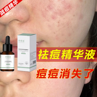 ����AҺ�ˮ�����ഺ�����Ӷ�ӡ��Ʒȥ�۴��]���տsë�׾��A