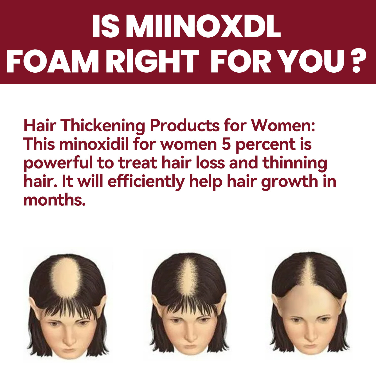 EELHOE hårvårdsskum för kvinnor, tätt hår fixerande djup reparation hårrötter hårsäckar återfuktande vårdskum_voghion.com