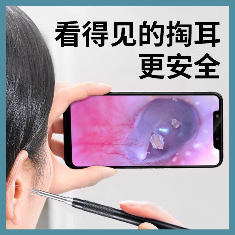 (2개) 휴대 전화 컴퓨터를 연결하는 고화질 오토스코프 외이도 내시경 귀 특종 시각적 귀 따기 악기 귀