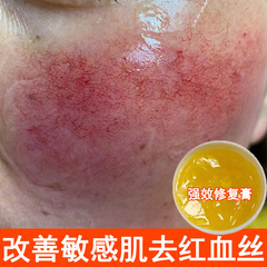 赤みを取り除く高効率修復クリーム、ホルモンフェイス修復、敏感肌、キューティクルの肥厚、赤みの軽減、キューティクル修復クリーム