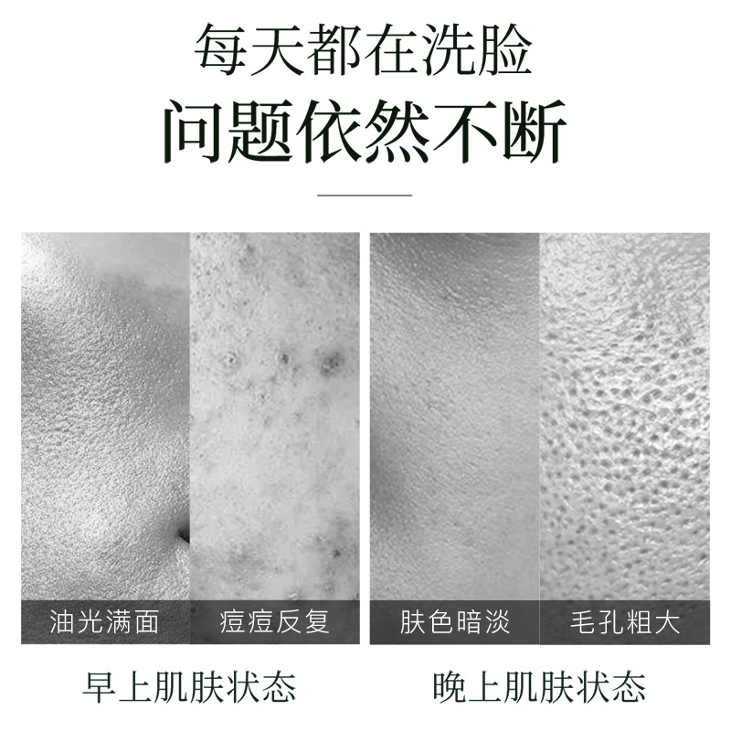 Yiluo facial hidratante limpiador facial, limpieza profunda de grasa, suciedad, hidratación, no tensión, limpiador facial para mejorar la piel