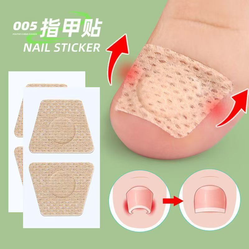 Factory Nail Care Patch Toe Pad Orthopedic Patch Nail Long Meat Special Soft Armor Repair Patch Orthopedic Patch