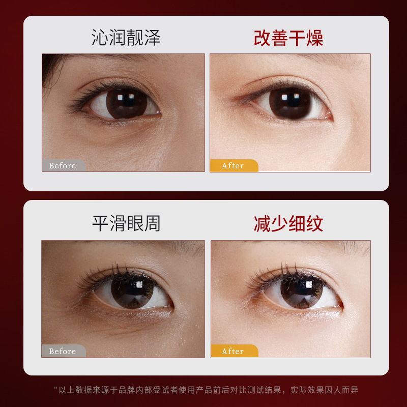 抖音热销眼部抗皱按摩精华油眼油滚珠按摩护理抗皱淡化细纹黑眼圈|undefined