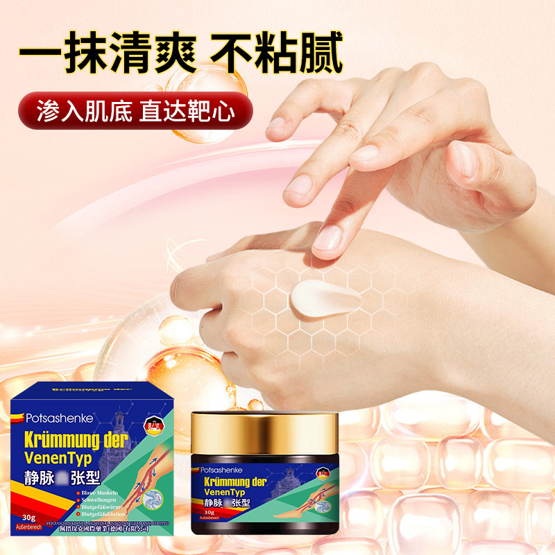 佩措琛克静脉膏30g 舒缓静脉膏疏通脉络平曲张腿部疼蚯蚓腿不适|undefined