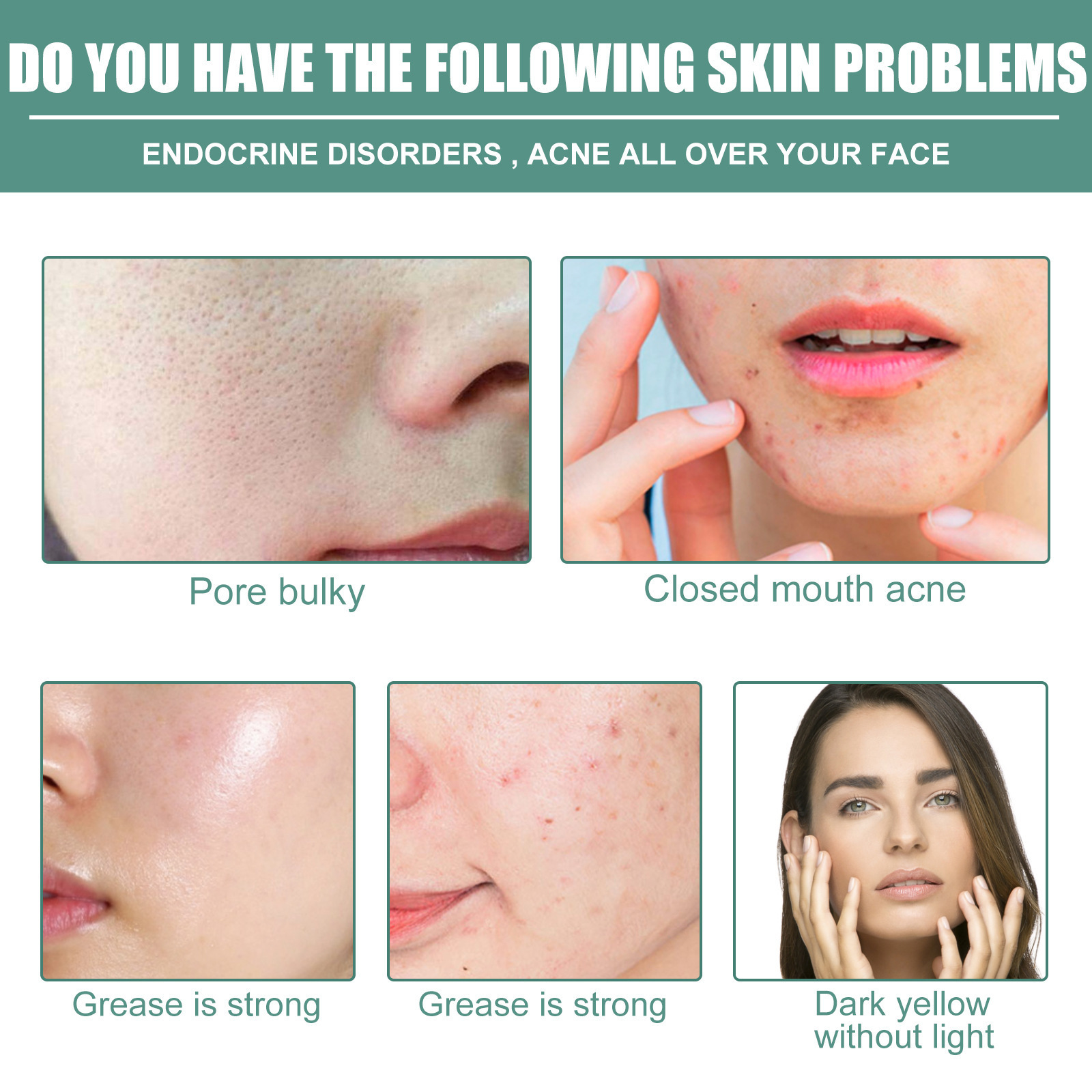 Το Jayswing essence ρετινόλης μειώνει τις λεπτές γραμμές, συσφίγγει το πρόσωπο, φωτίζει, συσφίγγει, ελαστικότητα, τρυφερότητα, αντιστέκεται_voghion.com