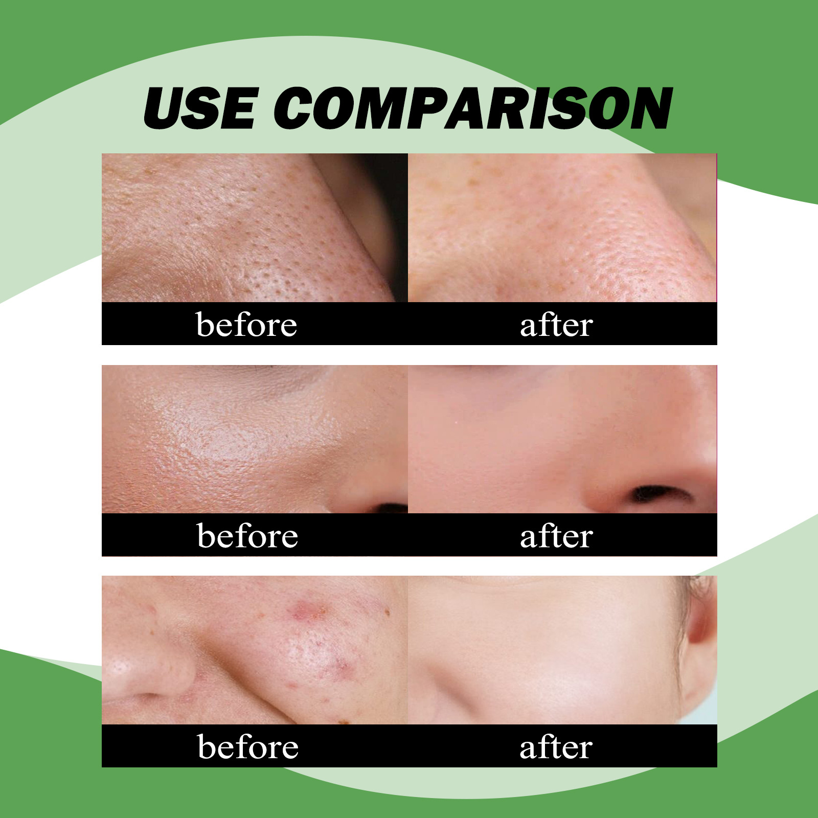 Jaysuing Bamboo Charcoal Facial Soap Black Head Cleaning, Repairing, Acne Removing, Refreshing, Oil Controllin_voghion.com