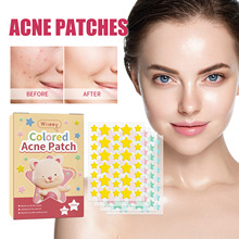 跨境专供 星星痘痘贴 面部清洁淡化痘印粉刺便携彩色五角星痘痘贴