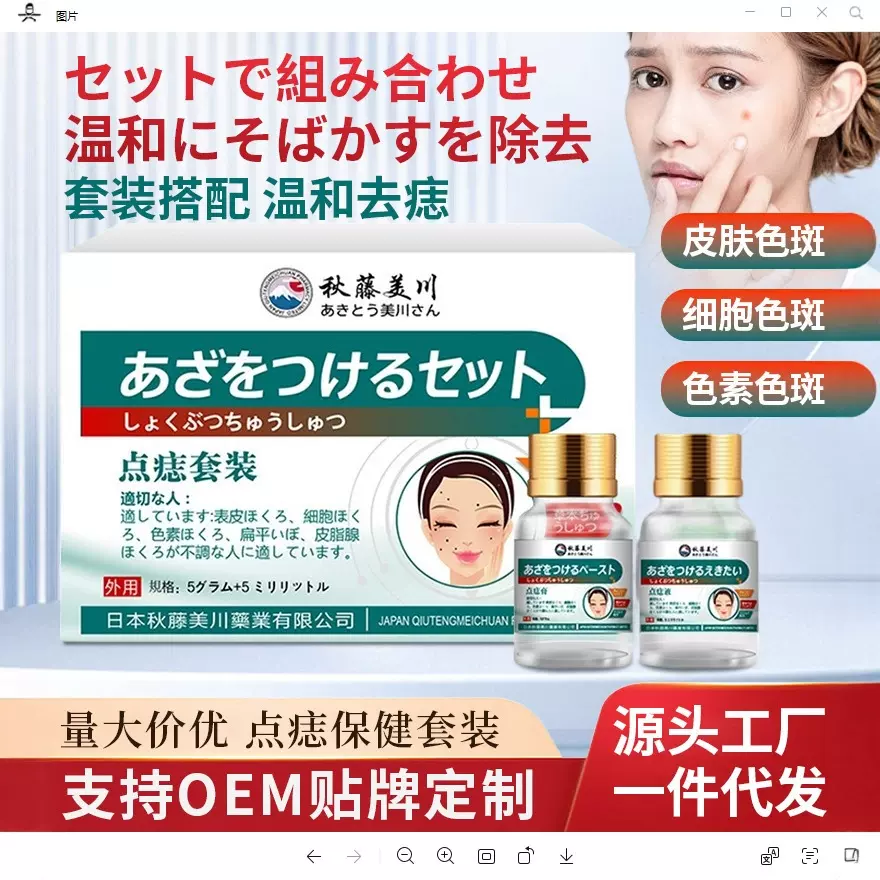 秋藤美川牌点痣套装 舒缓皮肤痣细胞痣色素痣不适保健套装批发