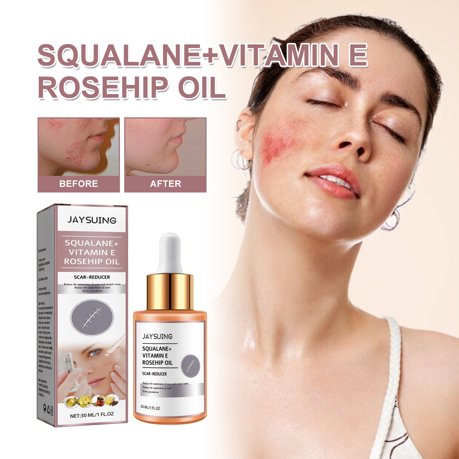 mars Squalane+Vitamin E Rose Fruit Oil to Desalinate Surgical and Remove Burn Marks from Cesarean Section Scars_voghion.com