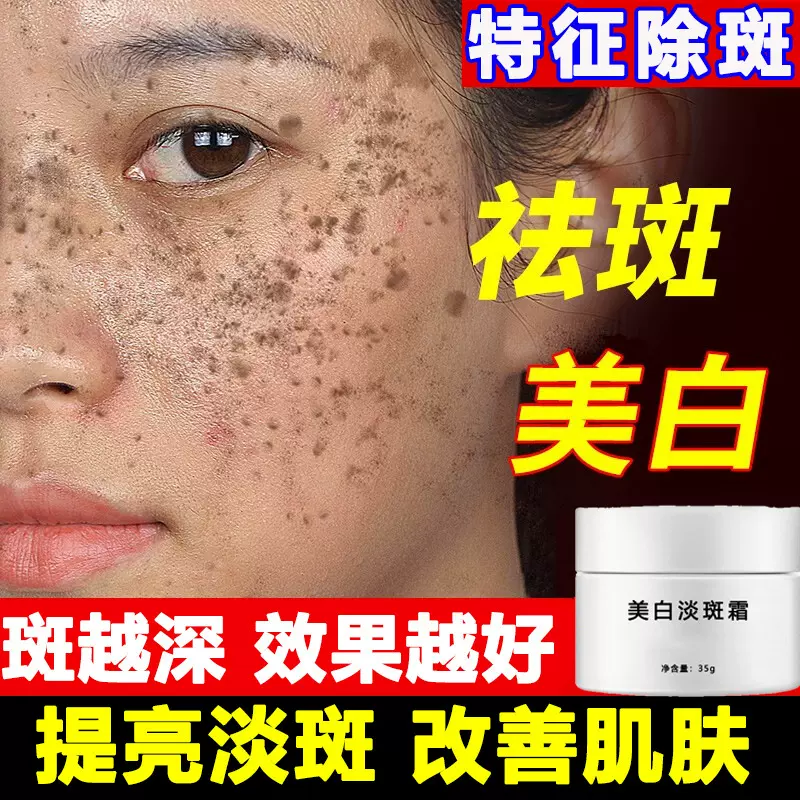 美白祛斑霜面霜水光焕颜提亮淡斑色斑雀斑嫩滑肌肤淡化色斑美容院
