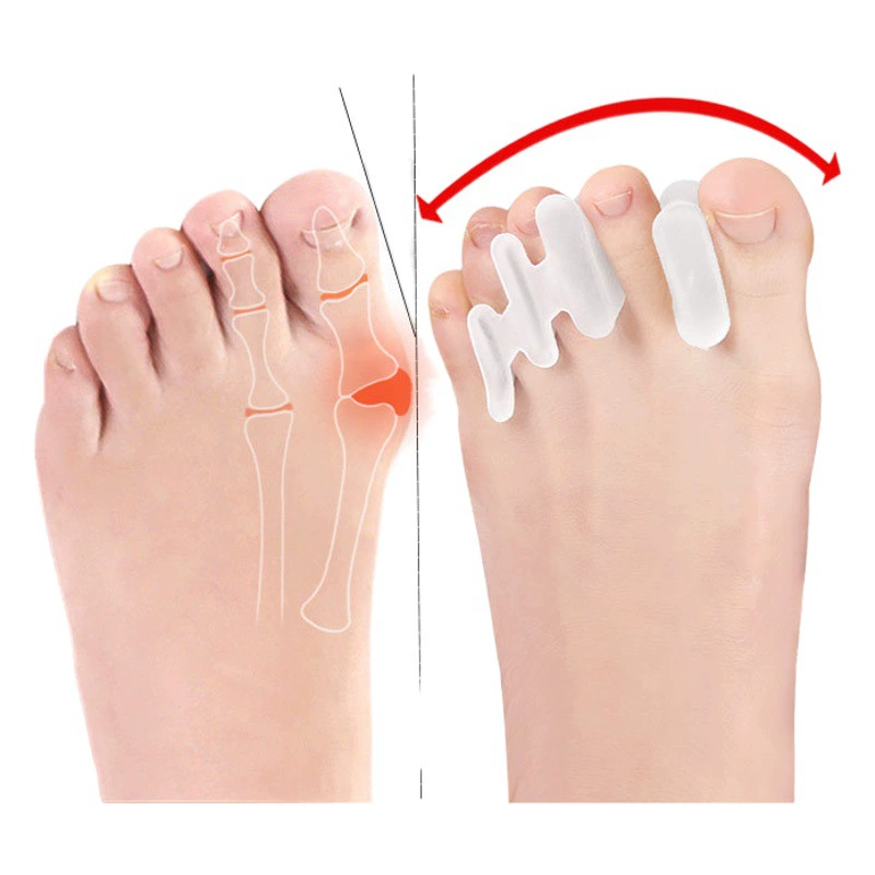 Зажим для ног Hallux Valgus Разрезной носок Большая кость стопы Перепритирочная коррекция пальцев ног Стелька для коррекции пальцев ног Стелька