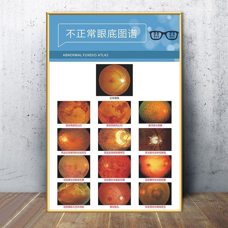 Fluorescent yellow 39-not normal eye bottom picture