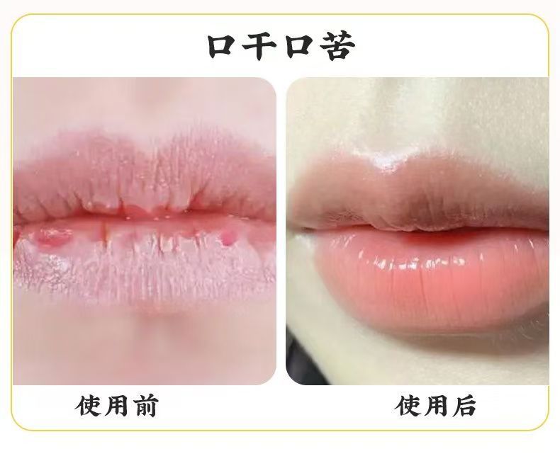Traditional Chinese medicine navel moxibustion powder navel moxibustion special powder children massage special moxibustion powder children navel moxibustion shenque moxibustion po