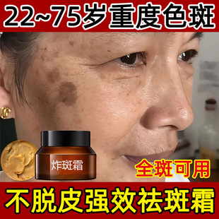 ����Ժ�������˪ը��˪ȥ��ɫ���S�ְ�����ߕ�����˪��Ч���b