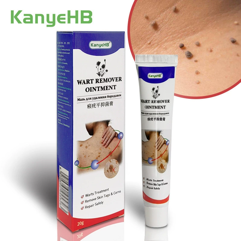 Wart Remover Cream Плоская обезьяна особенно бородавка крем Wish Amazon Ebay Lazada 20g