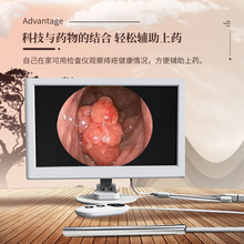 肛门后庭直肠内窥镜超清像素电子便携式10寸智能检查仪检测摄像头