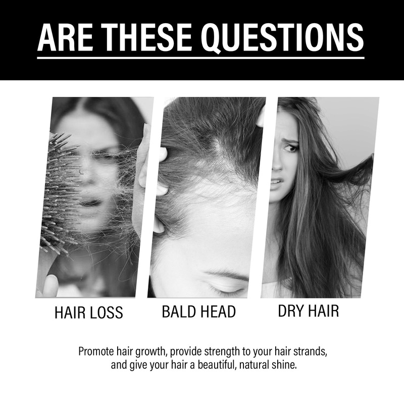 OUHOE ビオチンヘアエッセンス髪保湿頭皮マッサージケアヘアケアエッセンシャルオイル|undefined