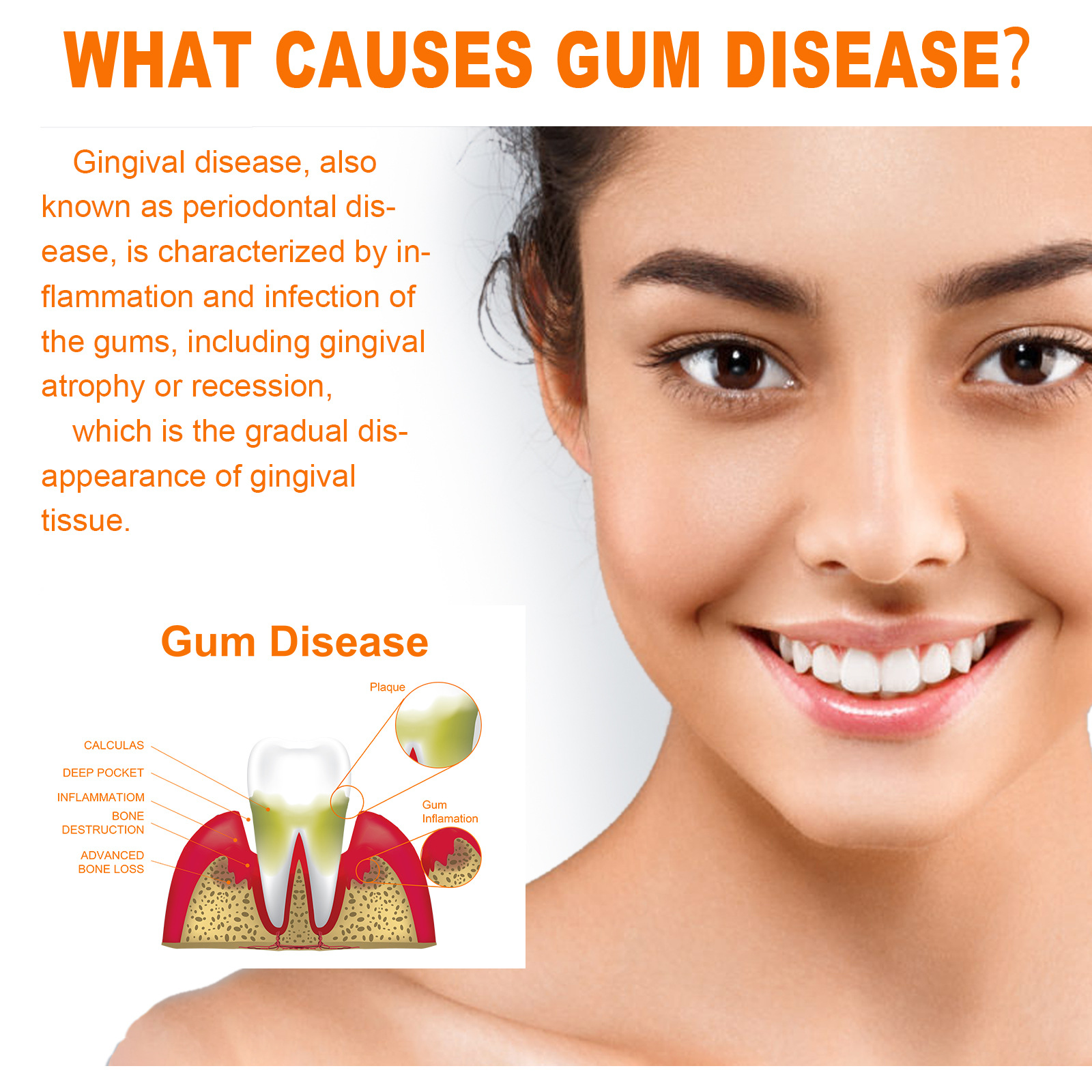 EELHOE 牙齒修護精華 深層清潔牙黃牙漬牙垢呵護牙齦口腔護理精華