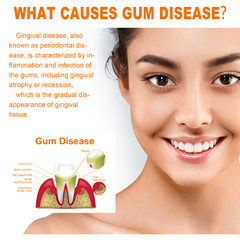 EELHOE 牙齒修護精華 深層清潔牙黃牙漬牙垢呵護牙齦口腔護理精華