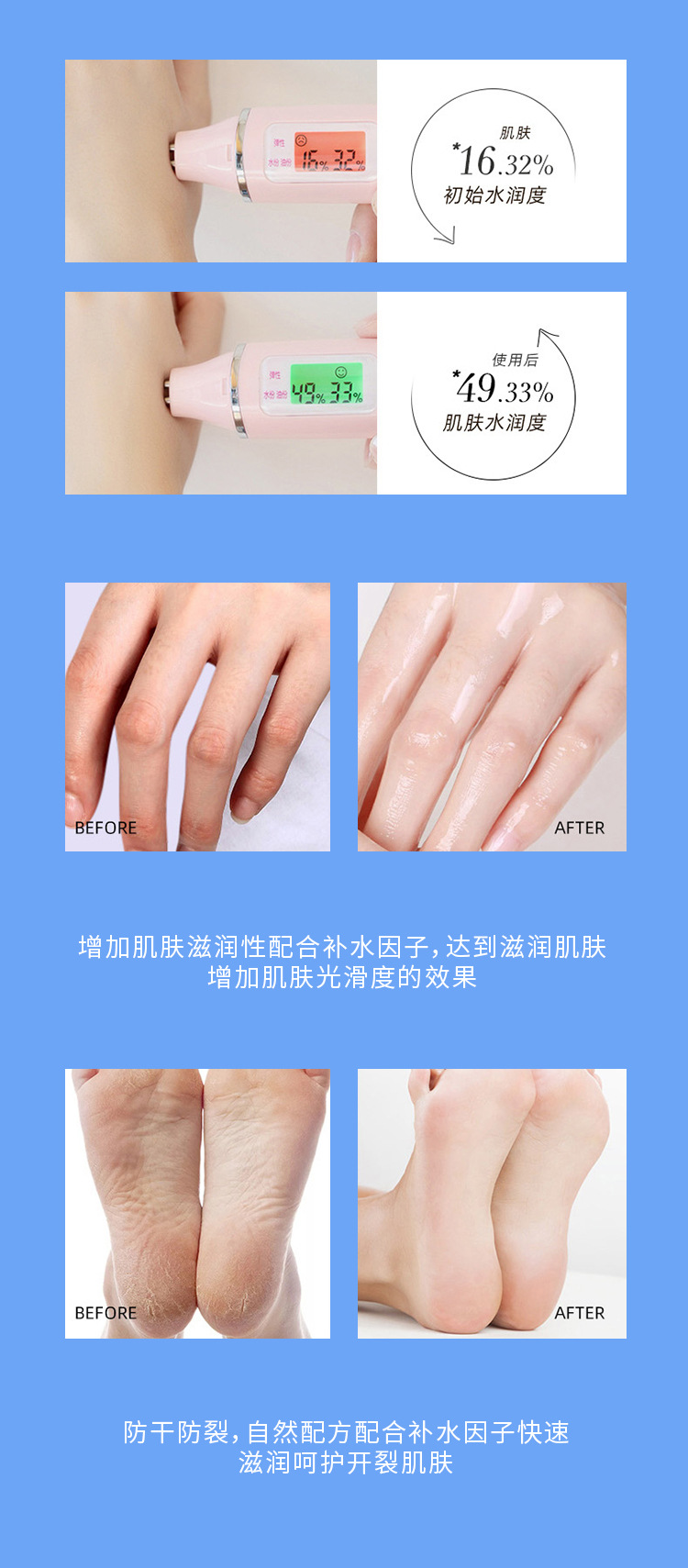 Vaseline Anti-Cracking Special Care Cream, Hand and Foot Anti-freezing Cream, Moisturizing and Hydrating Anti-freezing and Anti-Cracking Hand Cream, Extra Moisturizing Protective Cream undefined