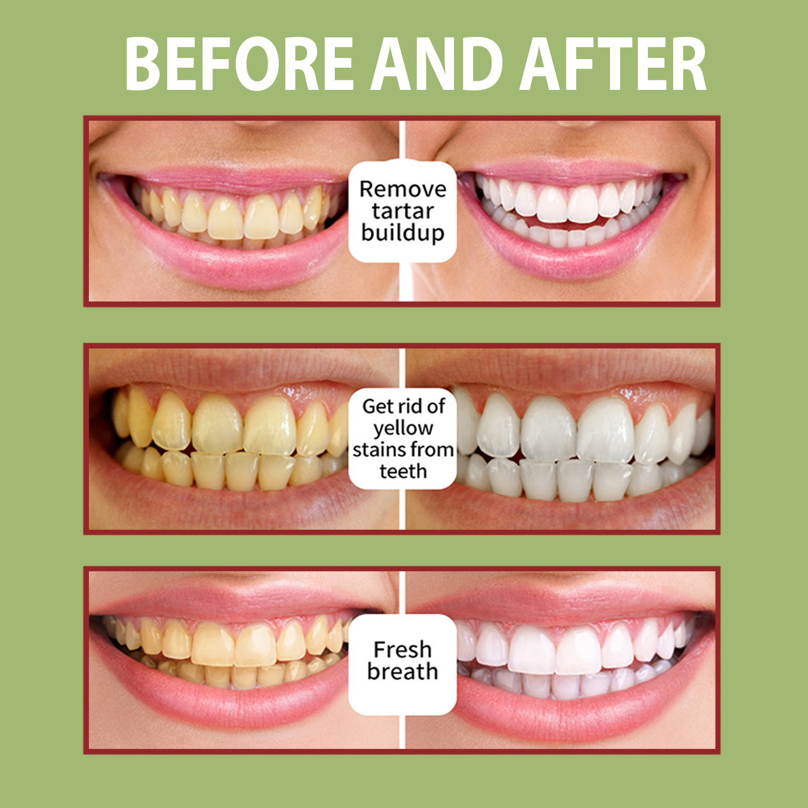 OUHOE Tooth Mousse Pulizia orale Denti gialli, alito cattivo, tartaro, macchie, dentifricio in schiuma antitarme_voghion.com