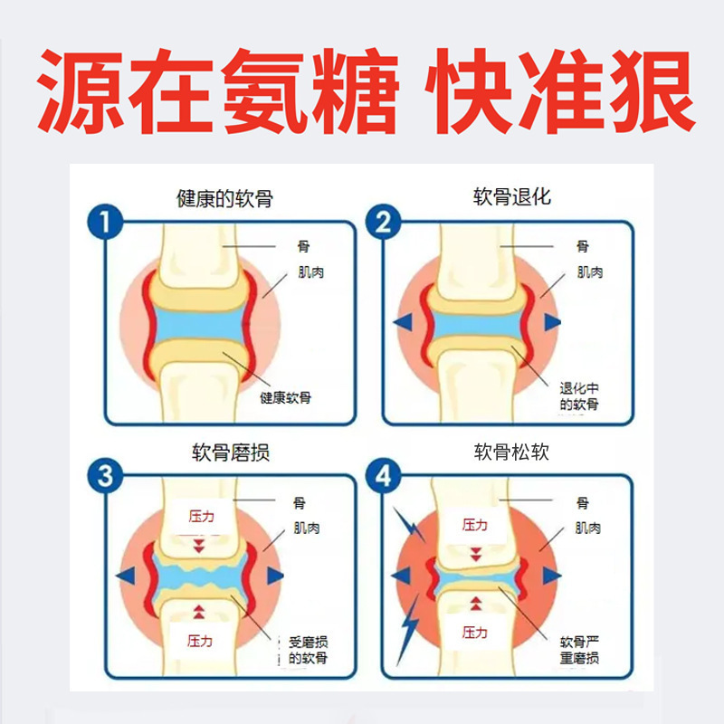 翼燕アミノサミン小緑色チューブは肌と関節を保護し、外用アミノサミンコンドロイチンスミアジェルをメーカー卸売で提供します|undefined